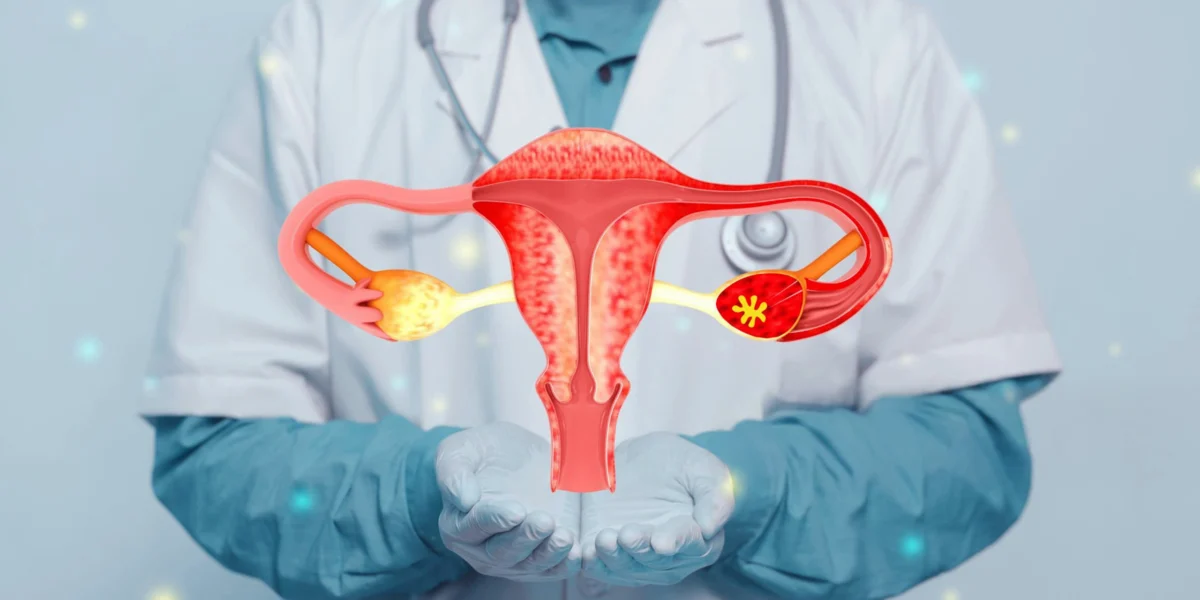 Endometriosis